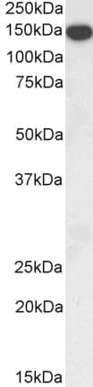 IHC-plus™ THBS1 / Thrombospondin-1 Antibody (aa19-32)