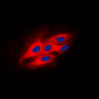 Polyclonal Rabbit anti-Human PRKCSH Antibody (Internal, IF, WB)