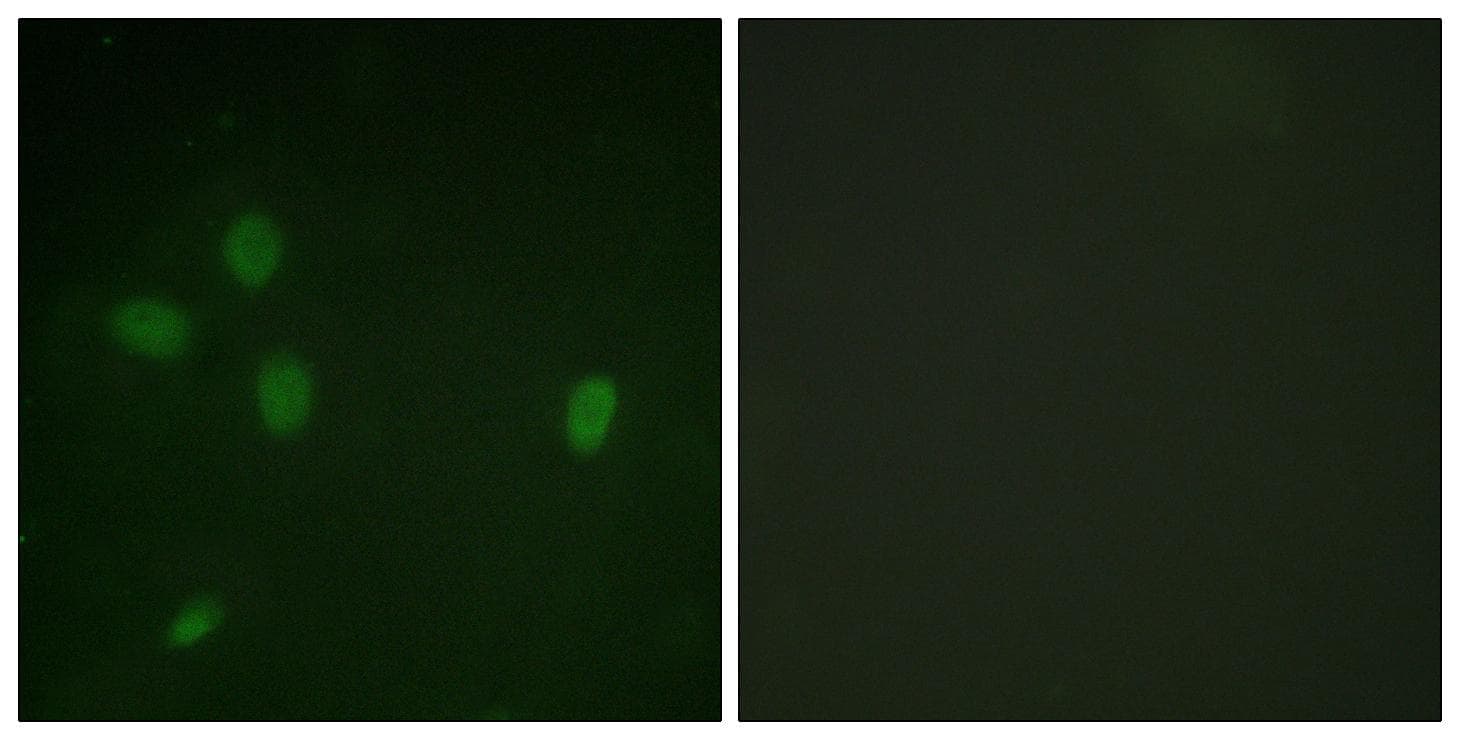 Polyclonal Rabbit anti-Human TP53BP1 / 53BP1 Antibody (phospho-Ser25, IHC, IF)