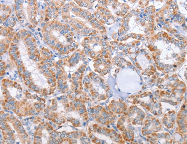 Polyclonal Rabbit anti-Human KIF3A Antibody (IHC, WB)