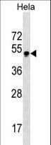 IHC-plus™ Monoclonal Mouse anti-Human GBX2 Antibody (aa103-131, IHC, WB)