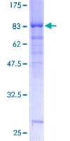 Human OXSR1 / OSR1 Protein (Recombinant GST)