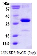 Human CDKN1B / p27 Kip1 Protein (Recombinant His)