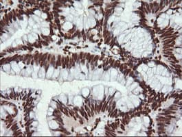 TRMT2A Antibody (clone OTI3D8, Carrier-free)