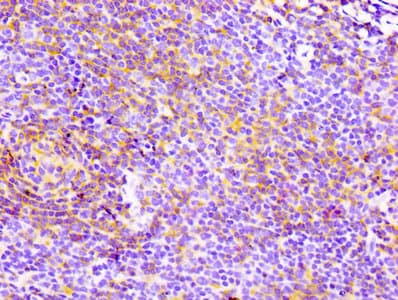 Recombinant Monoclonal Rabbit anti-Human CD4 Antibody (IHC, WB)