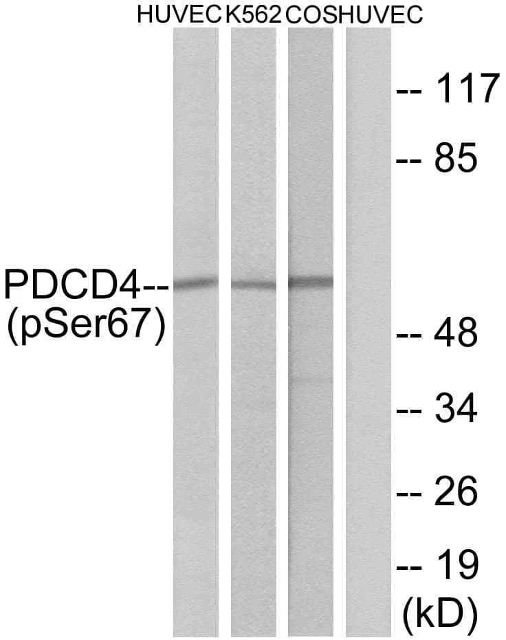 PDCD4 Antibody (phospho-Ser67)