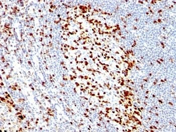 ZAP70 Antibody (clone ZAP70/528)