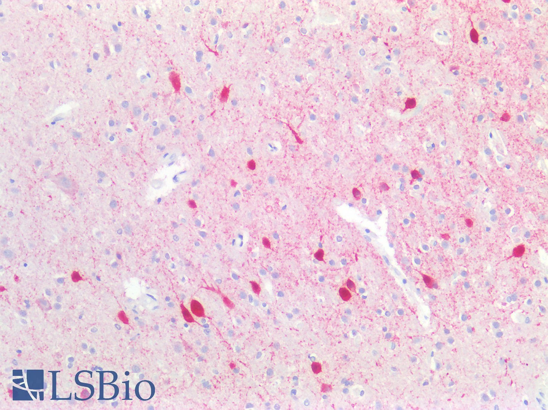 IHC-plus™ PVALB / Parvalbumin Antibody