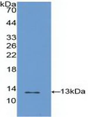 S100A4 / FSP1 Antibody (aa2-101)