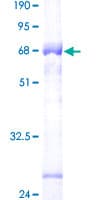 Human RPS2 / Ribosomal Protein S2 (Recombinant GST)