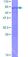 Human ARFGAP1 Protein (Recombinant GST)