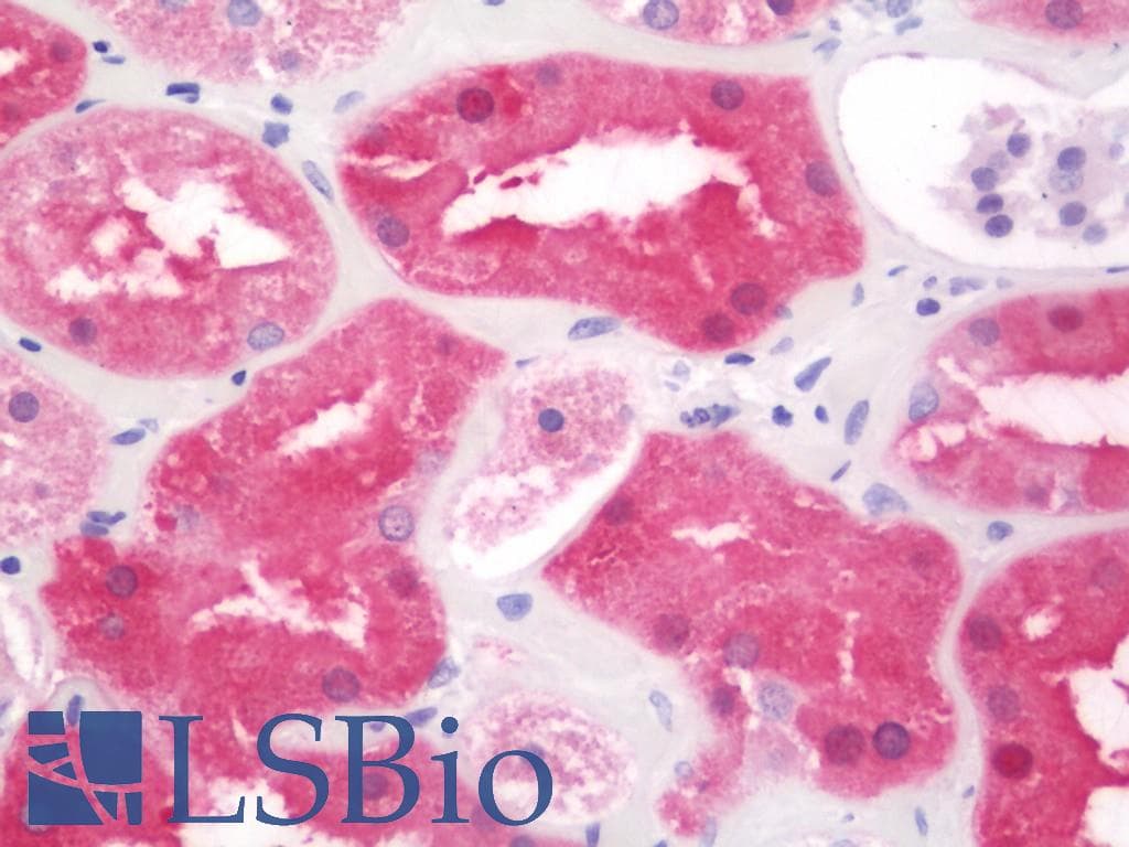 IHC-plus™ ZEB2 / SIP-1 Antibody (aa750-800)