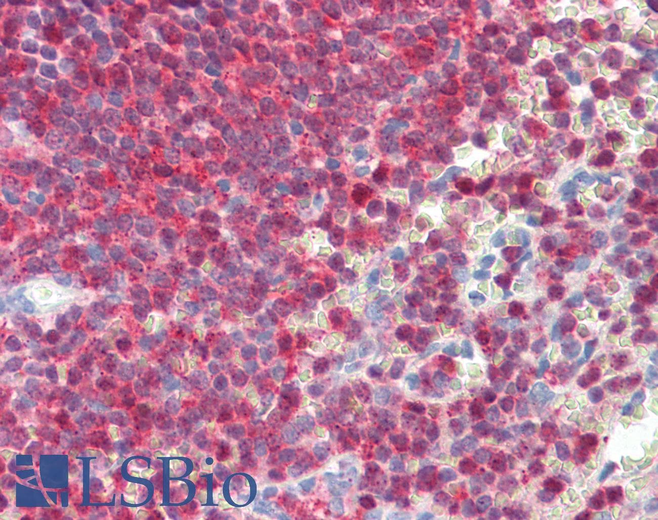 IHC-plus™ KLHL29 Antibody (aa261-310)