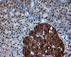 Monoclonal Mouse anti-Human ACLY / ATP Citrate Lyase Antibody (clone 3G8, Carrier-free, IHC, IF, WB)
