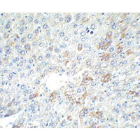 Polyclonal Rabbit anti-Human Alpha-Fetoprotein Antibody (IHC, IF, WB)