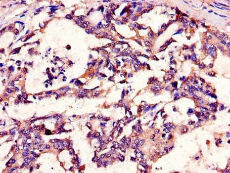 METTL14 Antibody
