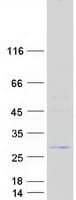 Human ACER1 / ASAH3 Protein (Recombinant Myc-DDK (Flag))
