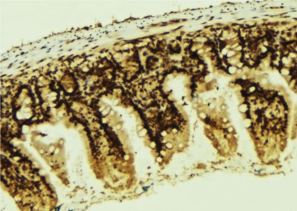 TP53 / p53 Antibody (phospho-Ser366)