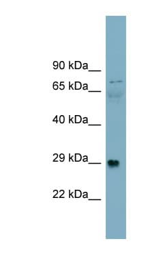 DAG1 / Dystroglycan Antibody (aa323-372, Biotin)
