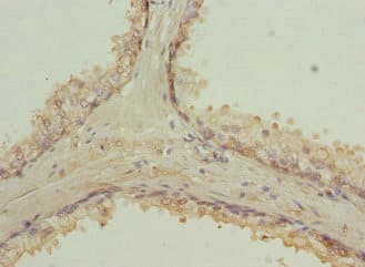 RAB9A / RAB9 Antibody