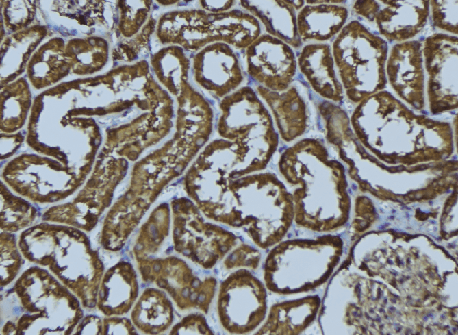 ACAA2 Antibody