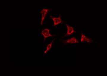 REM1 / REM-1 Antibody