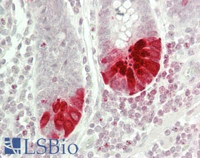 IHC-plus™ PEAK1 / SGK269 Antibody (aa95-144)