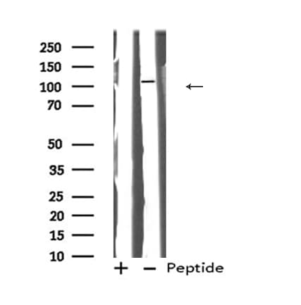 HYOU1 / ORP150 Antibody