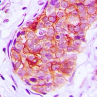 Polyclonal Rabbit anti-Human GRK6 Antibody (N-Terminus, IHC, WB)