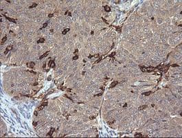 FCGR1A / CD64 Antibody (clone 3D3, Carrier-free)