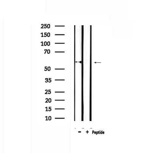 P450SCC / CYP11A1 Antibody