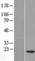 CABP5 Protein (Over-Expression Lysate Myc-DDK (Flag))