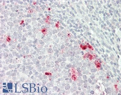 IHC-plus™ Polyclonal Rabbit anti-Human ATRIP Antibody (aa190-239, IHC, WB)