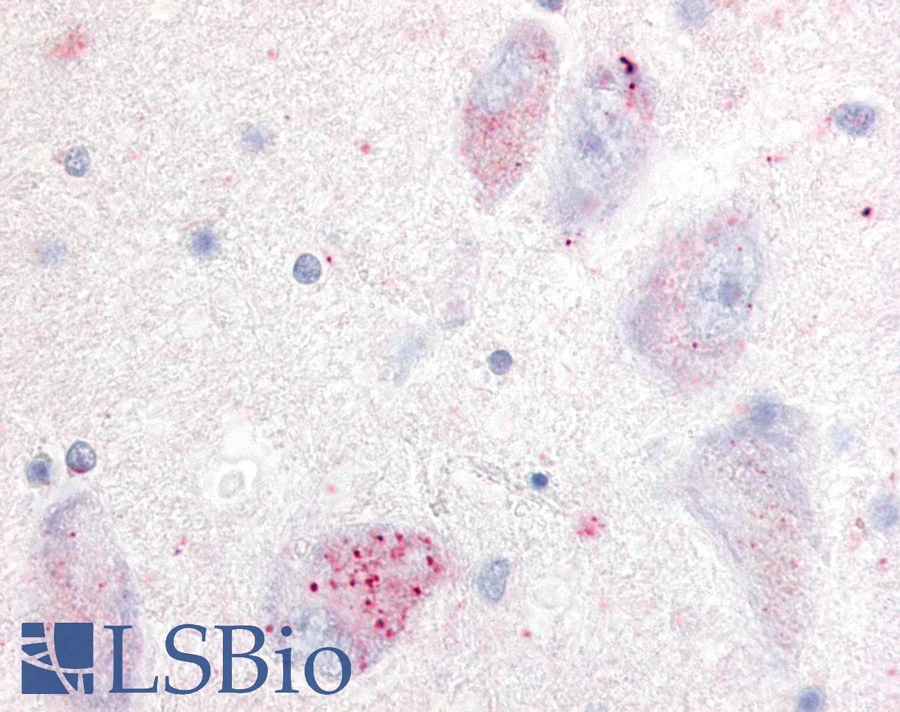 IHC-plus™ Polyclonal Rabbit anti-Human GPR20 Antibody (Cytoplasmic Domain, IHC)