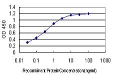 IHC-plus™ ARID1B / BAF250B Antibody (clone 2D2)