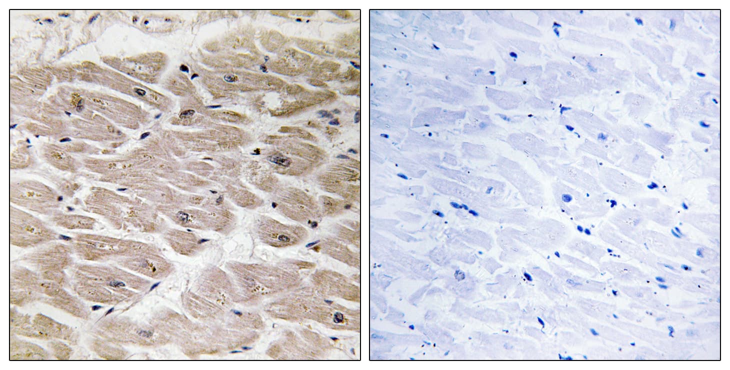 Polyclonal Rabbit anti-Human AGBL2 / CCP2 Antibody (aa731-780, IHC, WB)