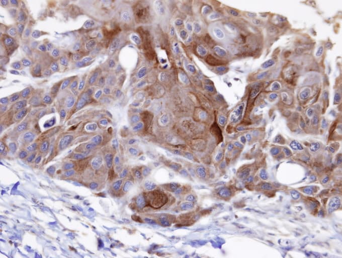 OSBPL6 Antibody (aa872-934)