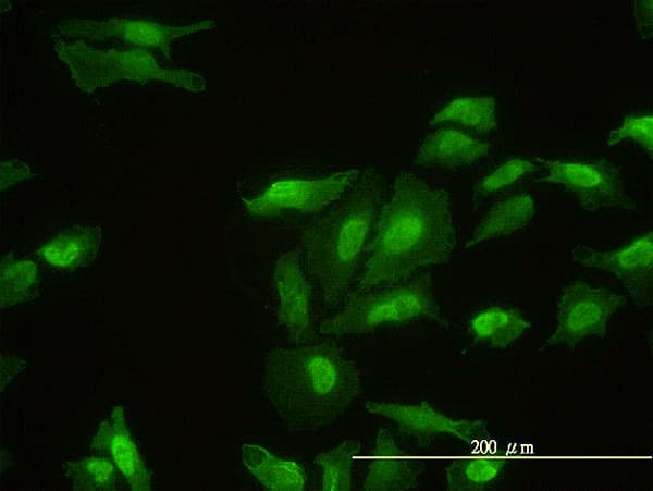 Monoclonal Mouse anti-Human FHL2 Antibody (clone 2G3-1A5, IF, WB)