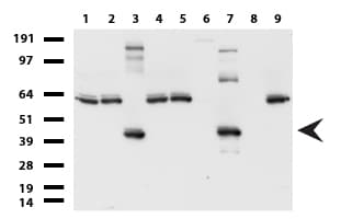SYP / Synaptophysin Antibody (clone UMAB112)