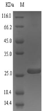 Human SRI / Sorcin Protein (Recombinant GST, N-terminus)