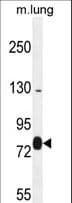 EXOC8 / EXO84 Antibody (aa360-389)