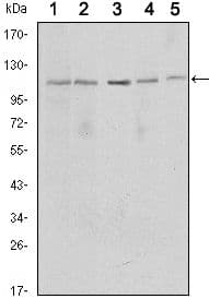 SIRT1 / Sirtuin 1 Antibody (clone 1F3)