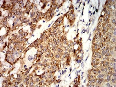 Monoclonal Mouse anti-Human AGR2 Antibody (clone 5G1F8, IHC, WB)