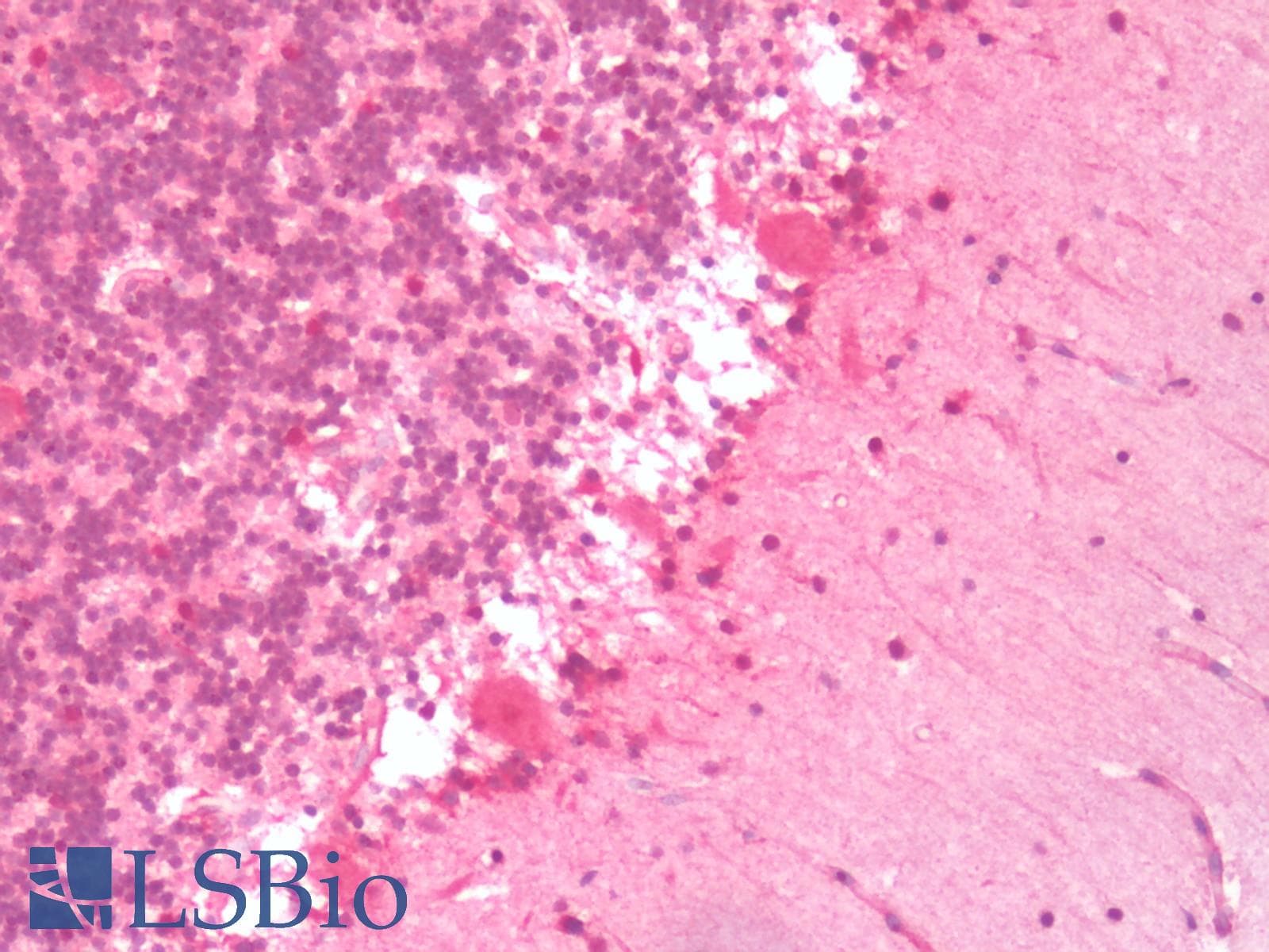 PathPlus™ HTR6 / 5-HT6 Receptor Antibody (C-Terminus)