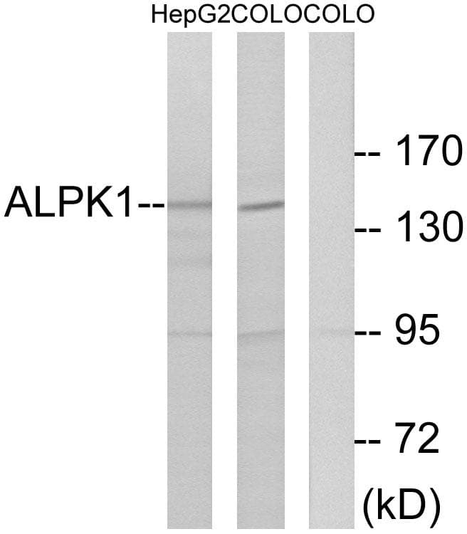 ALPK1 Antibody
