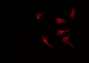 GTF3 / GTF2IRD1 Antibody