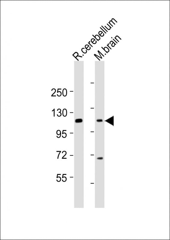 Polyclonal Rabbit anti-Human UNC5H2 / UNC5B Antibody (aa507-541, WB)