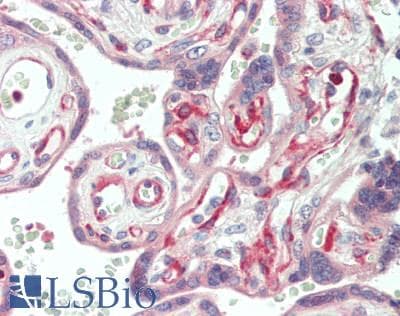 IHC-plus™ LAMA4 / Laminin Alpha 4 Antibody (aa1474-1508)