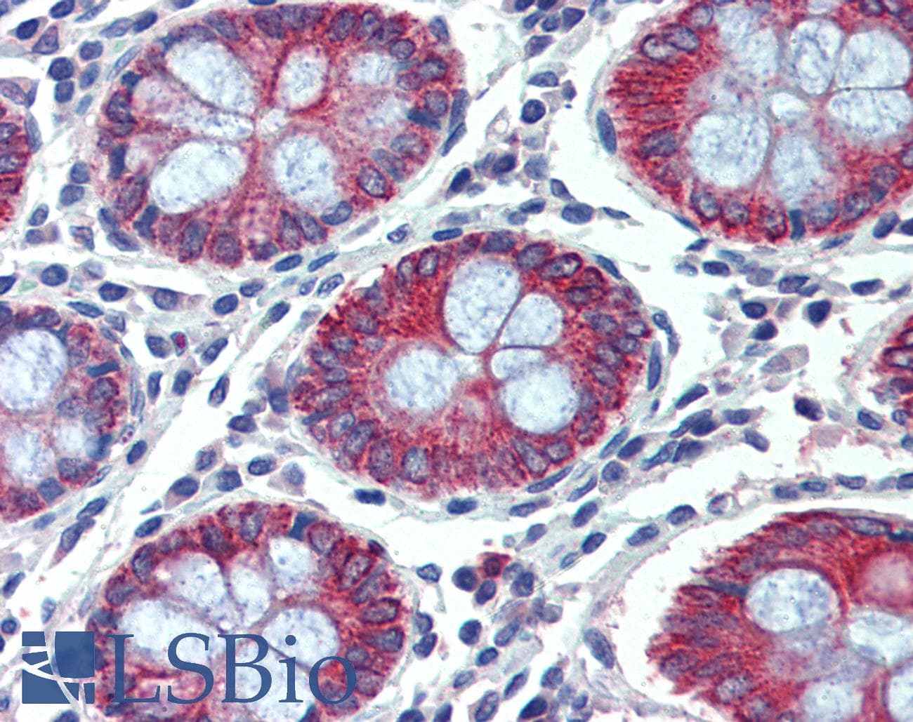 IHC-plus™ Polyclonal Goat anti-Human EPB41L2 Antibody (aa593-604, IHC, WB)