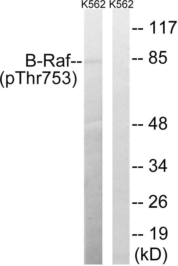 BRAF / B-Raf Antibody (phospho-Thr753)